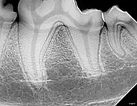 xrayteeth