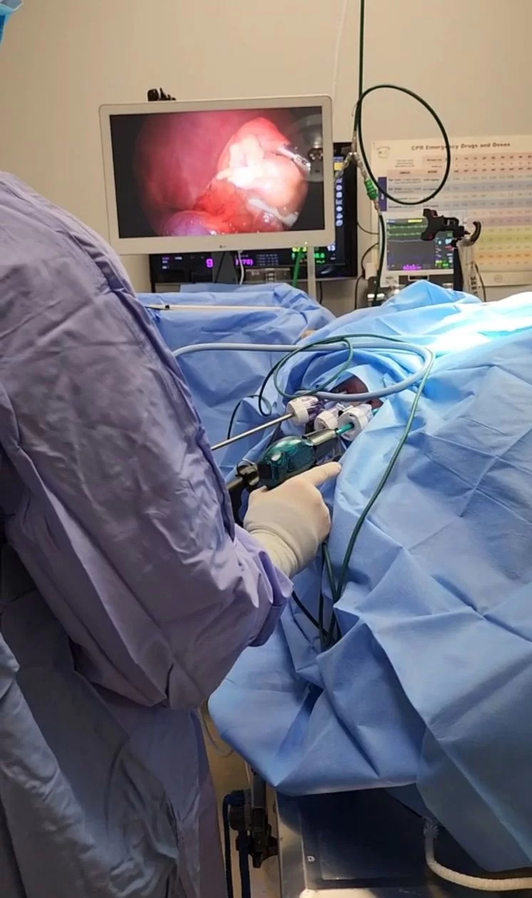 Endoscopic foreign body removal at Premier Veterinary Hospital in Tyler, TX