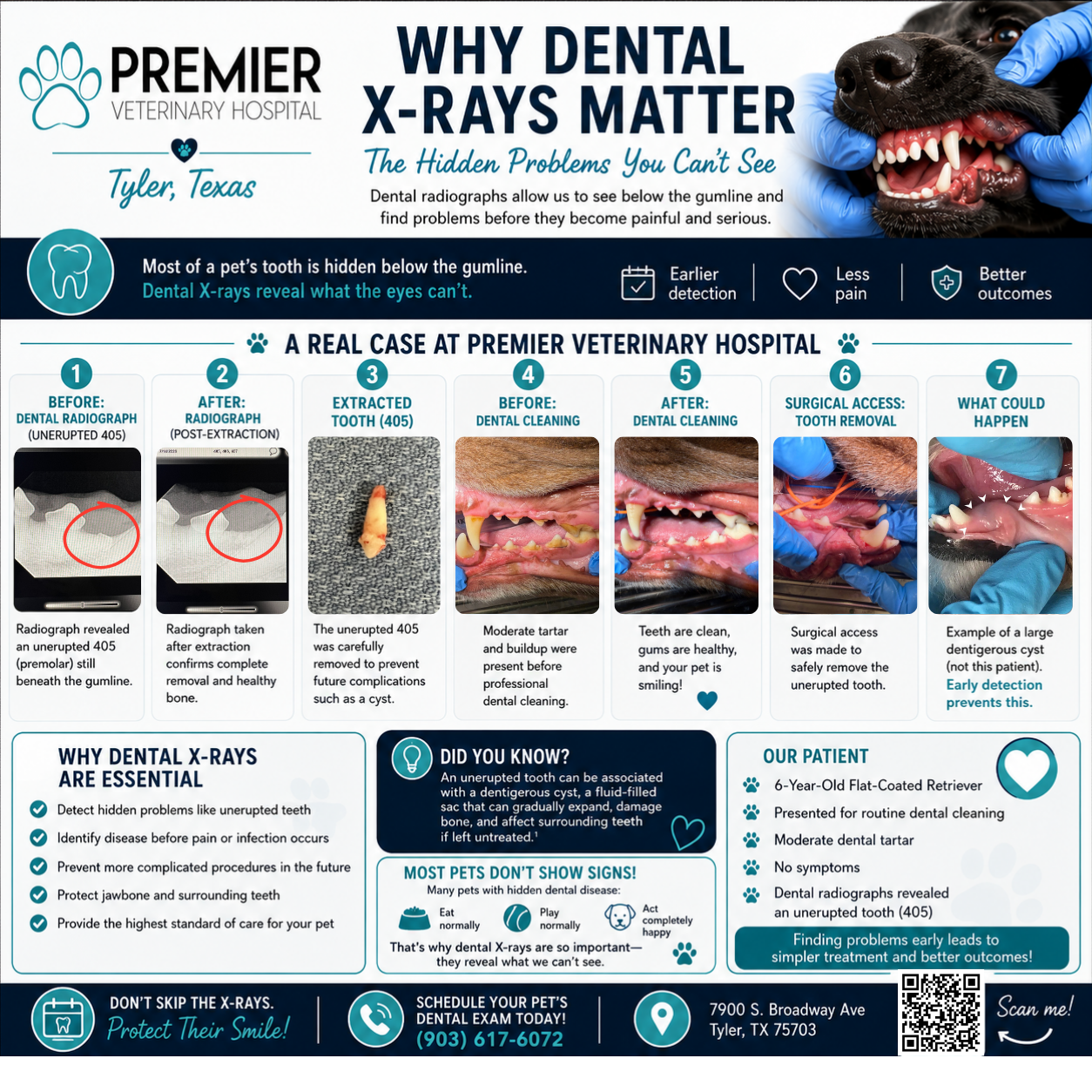 Why Dental X-Rays Matter