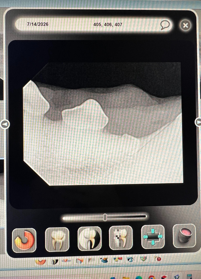 Why Dental X-Rays Matter