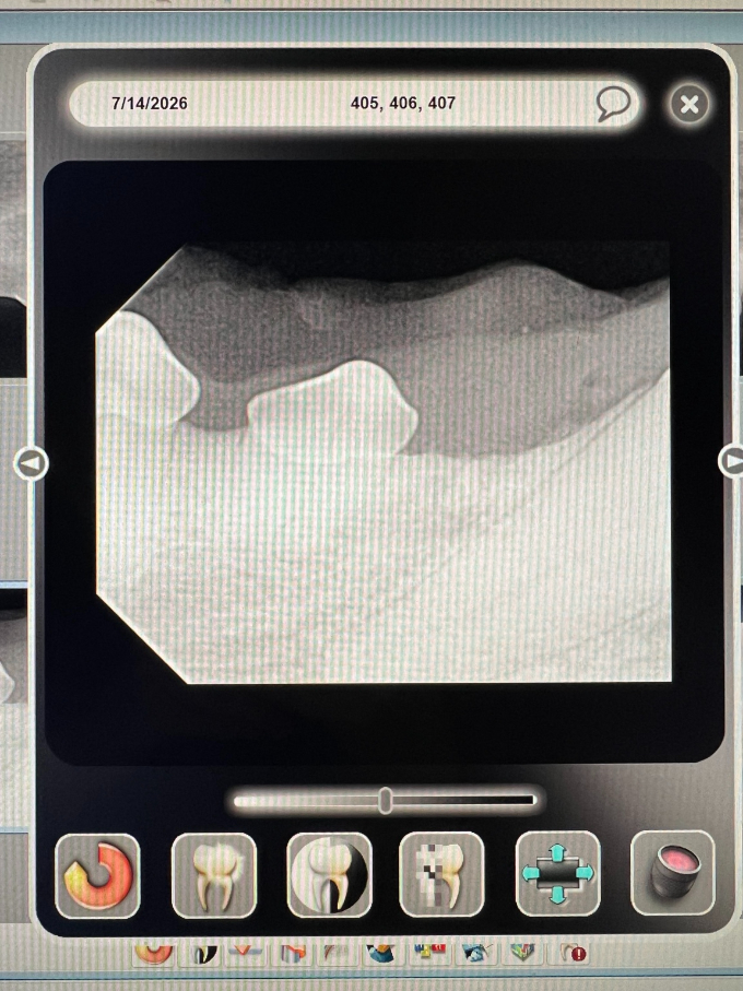 Why Dental X-Rays Matter